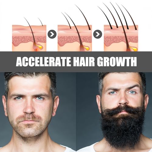 Beard Growth Kit mit Rollen Bartwuchsmittel Männer Schwarz Bart Wachstum 60 ml Bartwachstum Verdichtet und Stärkt Das Haarwachstum und Den Bart Geschenke für Männer und Väter