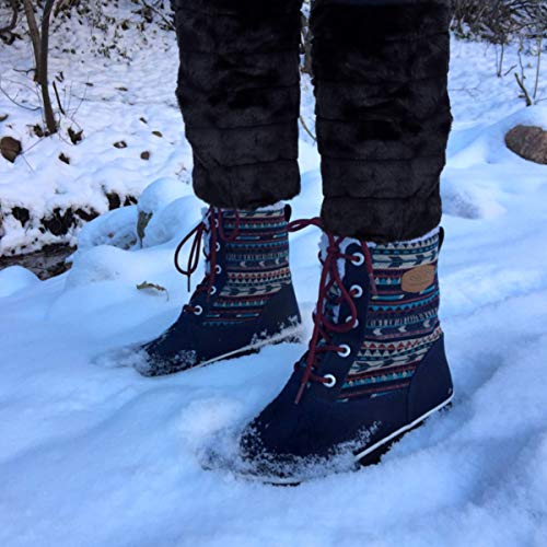 Image of BESPORTBLE Women Warmer Faux Rabbit Fur Leg Warm Cover Boot Shoe Warm Gaiter Cover for Ladies 30cm 1 Pair