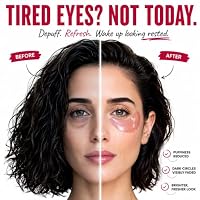 Eye Patches with Pink Peptides & Collagen for Puffy Eyes and Dark Circles — image 2