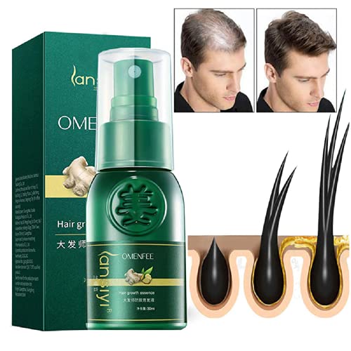 TSSPLUS New Ginger Hair Growth Essential Spray,Hair Growth Serum,Hair Growth Treatment, Hair Serum, Anti Hair Loss, Thinning, Balding, Repairs Hair Follicles, Promotes Thicker, Stronger Hair, And Promotes Hair Regrowth