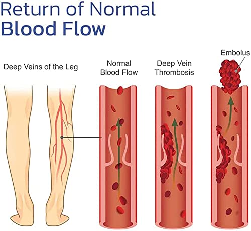 Kneeca Tourmaline Acupressure Selfheating Knee Sleeve, Tourmaline Acupressure Self-Heating Shaping Knee Sleeve, Mugwort Acupressure Shaping Knee Pads, Wormwood Self-Heating Knee Pads (Green, Large) #TOP6