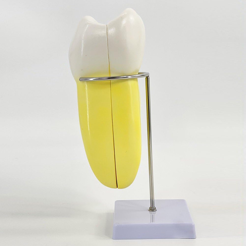 Modèle D'anatomie Modèle De Dents Molaires pour L'étude des Maladies Modèle De Dents Modèle De Dent Humaine