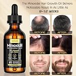 5% Minoxidil Hair Growth Oil for Men & Women Kit - Extra Strength Regrowth Serum, Topical Hair Loss Treatment Serum, Thicker, Healthier Hair & Beard Growth Kit, 2.11 fl.oz - Image 3