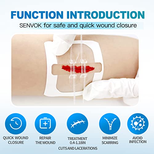 Senvok Butterfly Bandaids For Wound Closure, 2 Pcs Zip Stitch Wound Closure Strips, Surgical Laceration Repair Without Sew - Quick Clot - Emergency Wound Closures Device (Pu) #TOP1