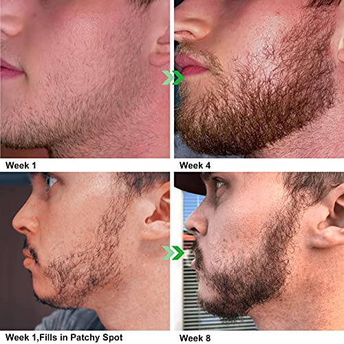 The 26 Best Beard Growth Kits of 2024 [Verified] Cherry Picks