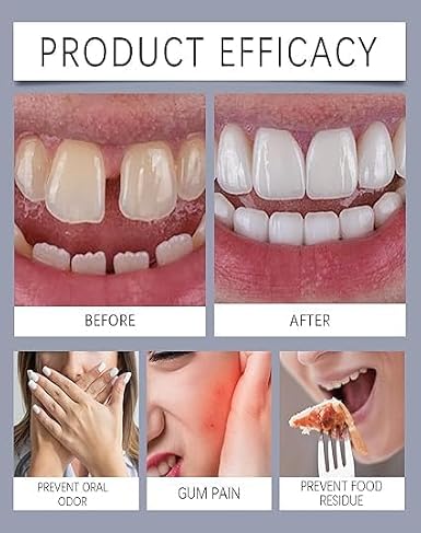 All Day Secure Denture Bond - Denture Bond Uses Thermoplastic Technology, to Perfectly Conform to Your Unique Gum Shape - Waterproof and Food-Proof, Effective up to 4 Days (1pcs)