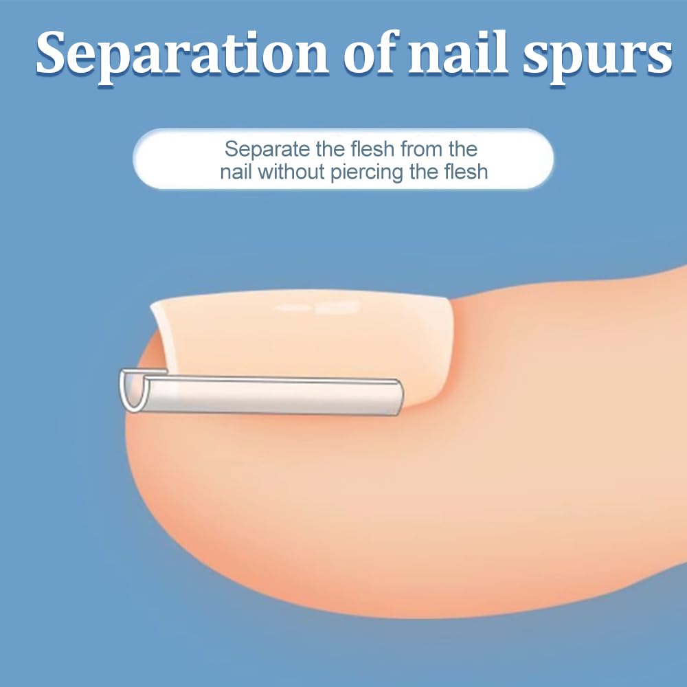Ensemble Correcteur d'Ongles Incarnés - 50 Bandes Sans Douleur pour Redresser les Ongles avec Élévateur d'Ongles - Kit Facile à Utiliser d'Outils pour Ongles Incarnés