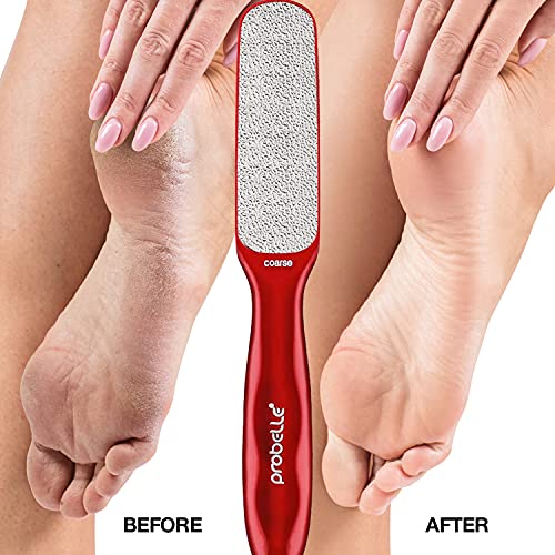 Probelle Double Sided Multidirectional Nickel Foot File Callus Remover - Immediately Reduces Calluses And Corns To Powder For Instant Results, Safe Tool (Red) #TOP3