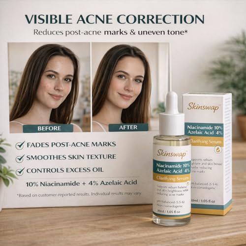 Image of Active 14% Niacinamide Serum with Azelaic Acid | Clarifying Face Serum for Brightening & Oil Control | Helps Reduce Acne, Blemishes & Acne Marks | Smooth, Clear-Looking Skin | For Women & Men | 30 ml