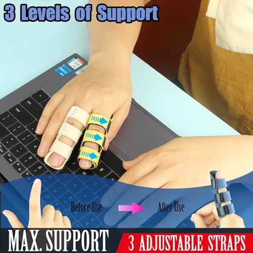 Kecartu 6 Pack Trigger Finger Splint, Finger Support Brace with Adjustable Fixing Belt for Straightening, Sprained, Tendinitis, Broken Finger Fits Index Finger,Middle Finger, Ring Finger (3 Straps) - Image 3