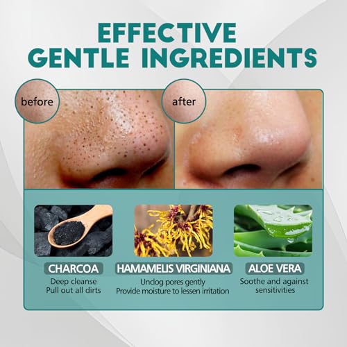 Mitesserentferner Stripes, 80 Stück Natürliche Bambuskohle Mitesser Entferner, Zum Entfernen von Mitessern und Zum Freimachen Verstopfter Poren