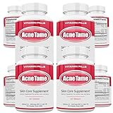 Acnetame Acne Pills Supplement- Clear Skin Vitamins Pill for Oily Skin Treatment, Hormonal Blemishes, Anti Spots & Cystic Acnes Supplements for Women, Men, Teens & Adults- 240 Oral Tablets