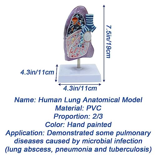 Modèle de poumon fumé pour formation médicale et démonstration des pathologies - 6