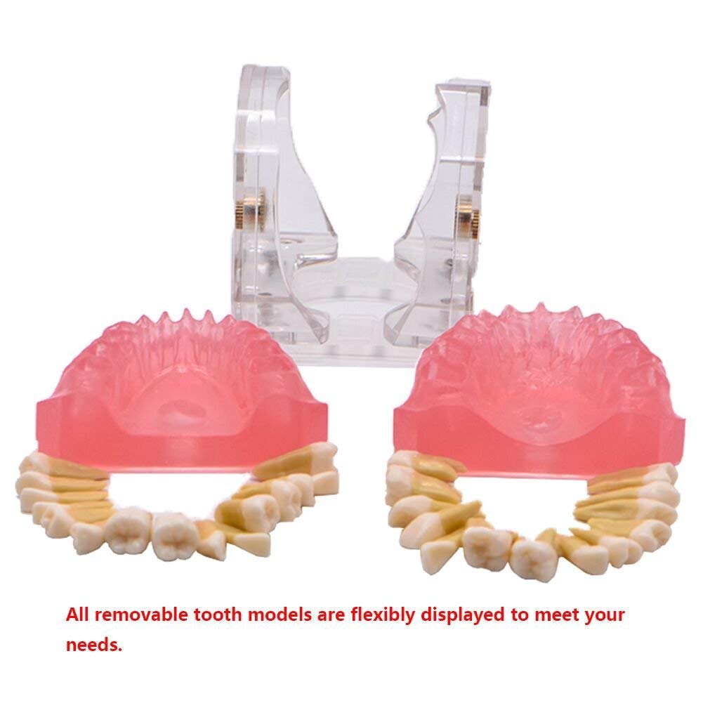 Modello didattico, Modello di Studio per impianti dentali, Modello Standard con Denti Rimovibili, Strumento di Studio didattico per Studenti di odontoiatria, pa