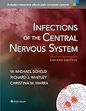 Infections of the Central Nervous System