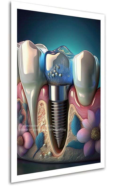 ice Crown Implant Art Artwork StatusRing Dentist Poster without Frame-picture-19