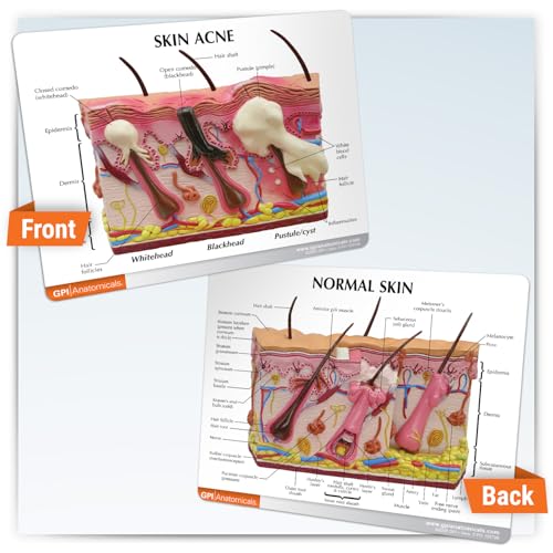 Image of GPI Anatomicals Cross-Section Skin Acne Model, Normal & Acne-Riddled Skin