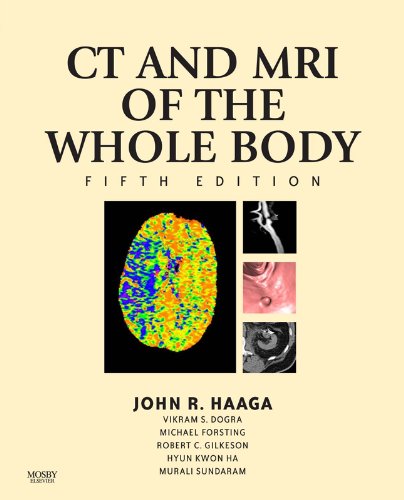 Computed Tomography & Magnetic Resonance Imaging Of The Whole Body (Computed Tomography and Magnetic Resonance Imaging of the Wh) (English Edition)