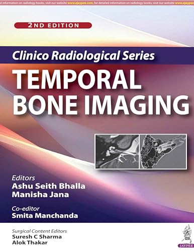 Clinico Radiological Series: Temporal Bone Imaging