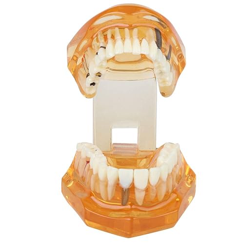 Miniatura 3 de Mrisata Study Teaching Teeth Model, Standard Teeth Model Adult Standard Typodont Demonstration Denture Model for Kids Dental Teaching, Clean