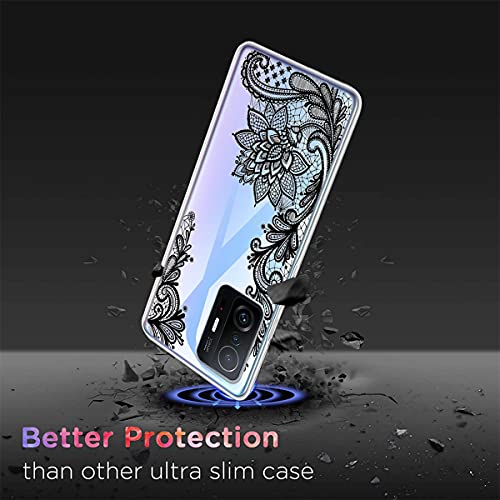 SCDMY Custodia per Xiaomi 11T / Xiaomi 11T PRO