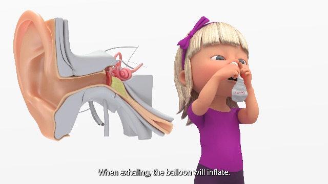 AYIOS - Otovent® First-line Treament For Negative Pressure In The Middle Earnatural Altern - View #6