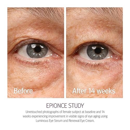 Epionce Creme de Olhos Renovador - Antienvelhecimento, Olheiras e Inchaço, Ácido Hialurônico, Ilumin