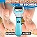 Rechargeable Electric Foot Callus Remover Tool – High-Speed 2800 RPM Electric Foot Sander Callus Remover with Replaceable Roller – Compact & Easy Maintenance, Up to 2-Hour Runtime for Smooth Feet