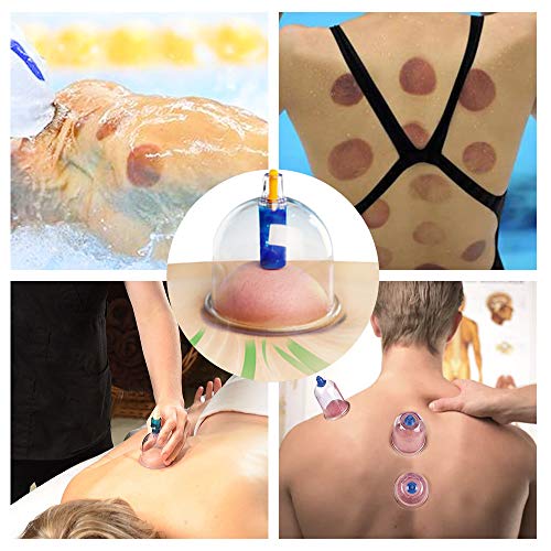 Scienlodic 12Pcs Cupping Set,Electric Cupping Therapy Set With Pump,Professional Vacuum Cupping Suction Cups Portable One-Key Start, Body Massage Pain Relif For Home, Salon Use #TOP3