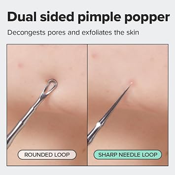 I DEW CARE 2-in-1 Proper Popper Dual-Tip Pimple Tool, Blackhead Remover
