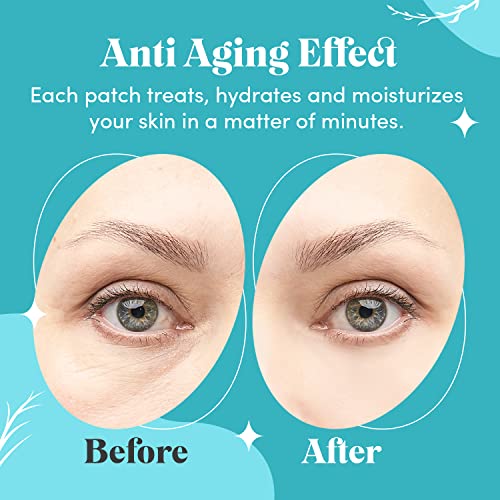 Hydra Blue Collagen Under Eye Gel Mask - Bright Eyes Anti Aging Treatment For Dark Circles, Puffy Eyes, Bags, Fine Lines - 30 Pairs (60 Total Patches) #TOP5