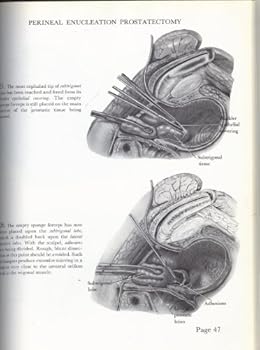 Hardcover An Atlas of Prostatic Surgery Book