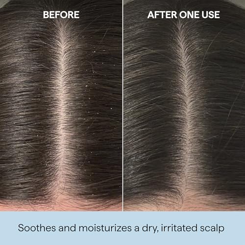 Briogeo Scalp Revival Rosemary & Castor Oil 3.4oz — view 2