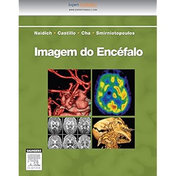 Capa do livro Imagem do encéfalo