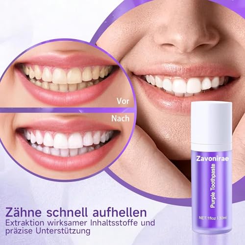 lila zahnpasta weisse zähne, lila Zahnaufhellung, 30ML Purple Teeth Whitening Toothpaste, Farbkorrektor Zahnpasta, Zahnfleckenentfernung, Tiefenreinigung, Whitening Zahnpasta, Zahnschmelzschutz