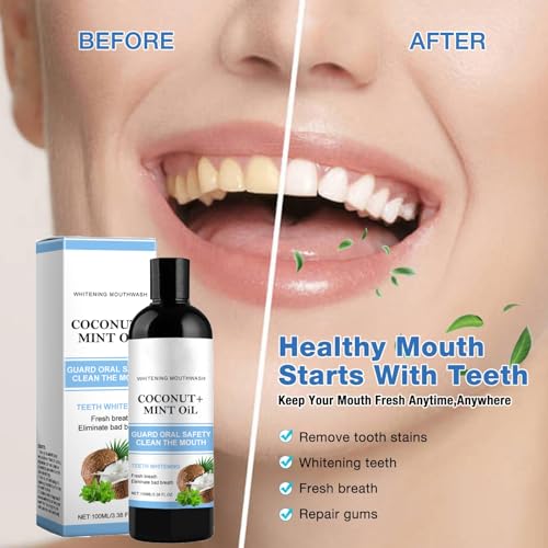 Aufhellendes Öl Mundspülung,Mundziehöl mit Kokosnuss& Pfefferminzöl 100ml mundziehoel kokos minze,Zahnaufhellung und Gesündere Zähne,Zungenreiniger,Oil Pulling for Teeth,Teeth Whitening Mouthwash (3) – Bild 6