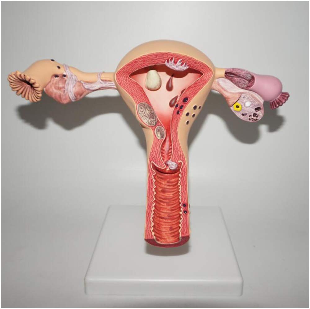 sjdoPulse Anatomical Pathological Female Uterus Model - Human Organ Anatomical Model Uterus Model - Female Reproductive System Uterus Ovary Model for Teaching Study (A)