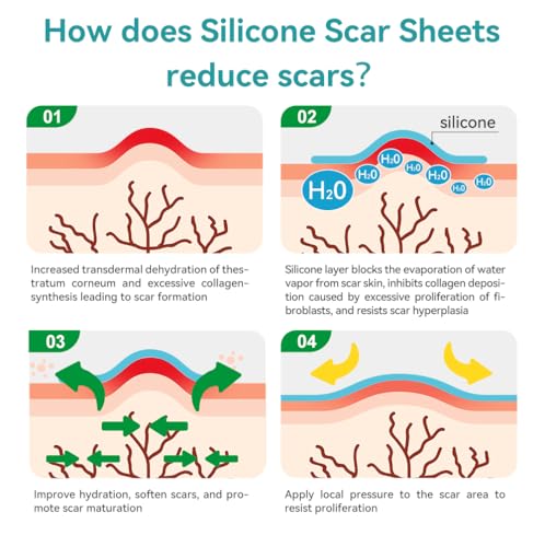 Dimora 120 072 Waterproof Silicone Scar Sheets thumb #4