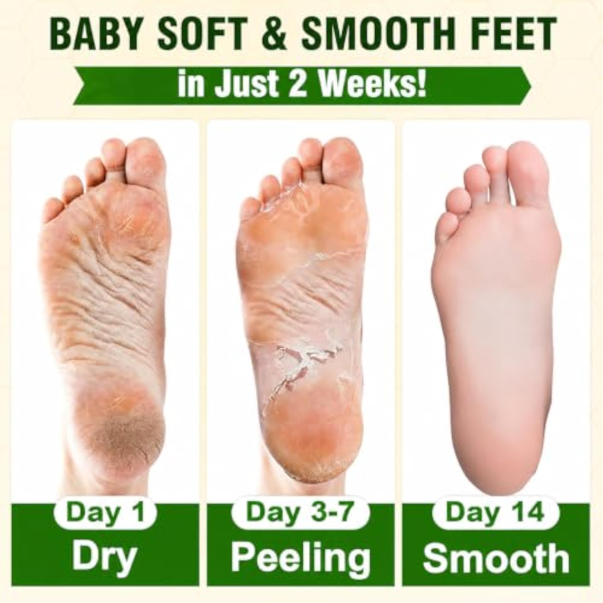 Foot Exfoliation Mask for Men and Women, Deep Cleansing Treatment