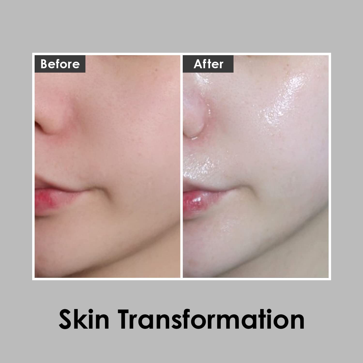 medi peel glutathione review Review] Medi Peel Glutathione White Ampoule 30ml Review in 2025 – LMCHING  Group Limited