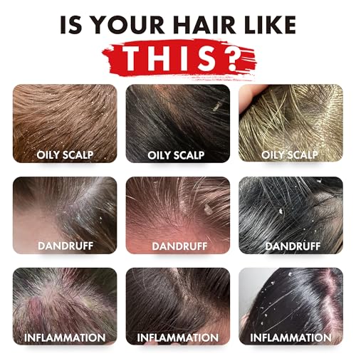 ALFHEIM Rosemary+ Purifying Shampoo & Conditioner Set Travel Size – Balancing Care for Oily & Fine Hair with Rosemary, Peppermint & Jojoba Oils – Deep Cleanse, Lightweight Hydration, Sulfate Free - Image 2