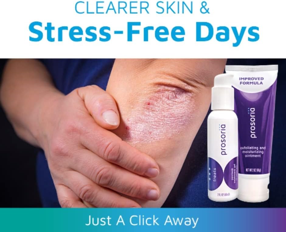 Miniatura 5 de Prosoria Kit doble de sistema de tratamiento  2 onzas  Potente alivio de la psoriasis con ácido salicílico, cúrcuma, manteca de karité y vitaminas