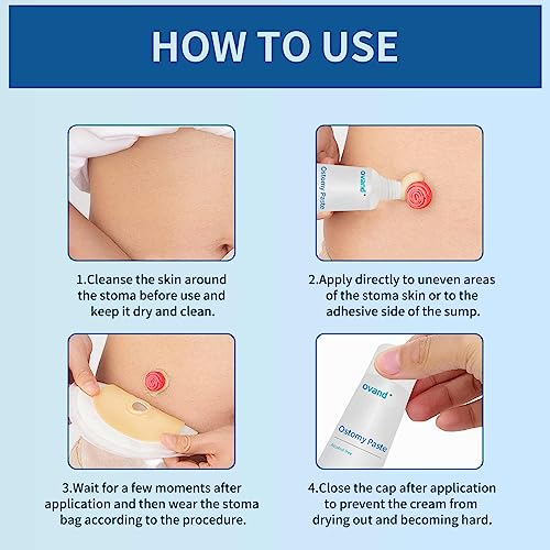 ostomy paste alcohol-free skin barrier ostomy paste for stoma filling to prevent leaks stoma care supplies ostomy supplies 2 box