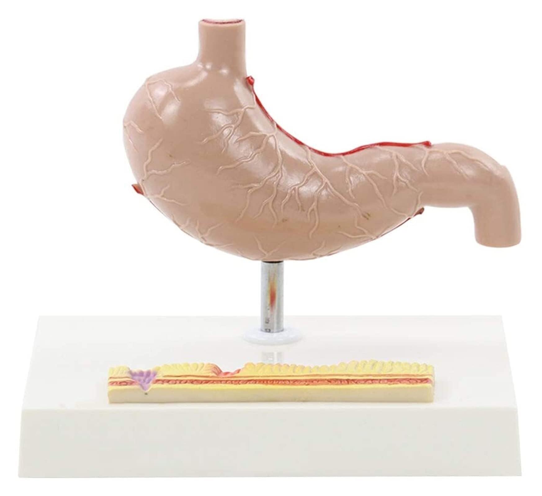 XINGLUOY Stomach anatomy model Human organ Anatomy and pathology teaching and learning aids