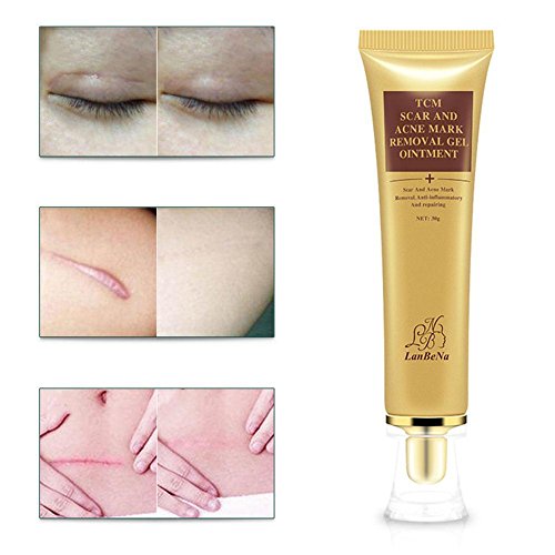 TCM Scar Cream, Acne Scar Removal Cream, Skin Repair Scars Burns Cuts