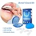 Y.F.M Professional Dental Guard - Thermoplastic Teeth Grinding Night Protector Stop Teeth Grinding & Eliminates Teeth Clenching - Teeth Whitening Tray - 2 Pairs with Storage Cases - BPA Free