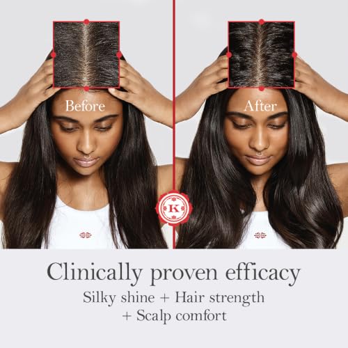 Image of BRINGARAS BALANCING SCALP & HAIR OIL 100 ML | Stimulates Hair Growth | Rebalances Scalp Health