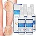 Produktbild AHSRW Veinfix Varicose Treatment Spray,Veinfix Varicose Treatment,Vein Fix Varicose Vein Spray,Vein Fix Spray,Vein Healing Varicose Veins Spray, Varicose Veins Treatment for Legs (4PCS)