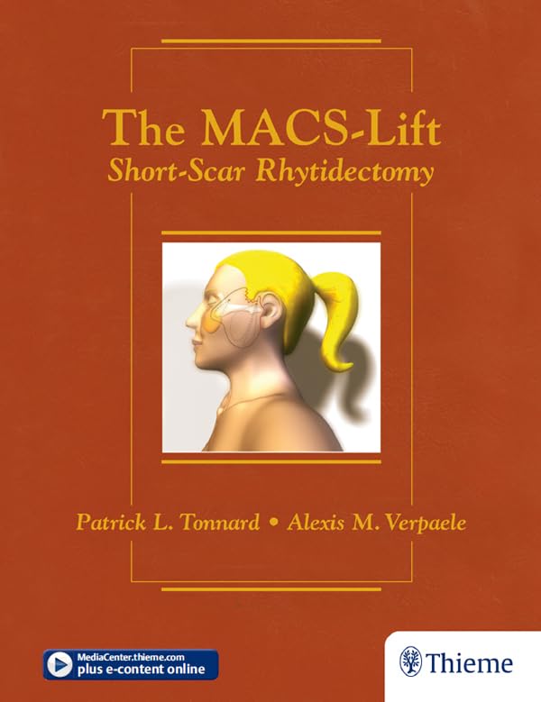 The MACS-Lift: Short-Scar Rhytidectomy (English Edition)