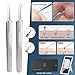 Professional Facial Blackhead Remover Tools,6-Piece Stainless Steel Acne Extractor Tools Set with Storage CaseKit for Whitehead Acne Blemishes Comedones Stainless Steel Makeup Tool